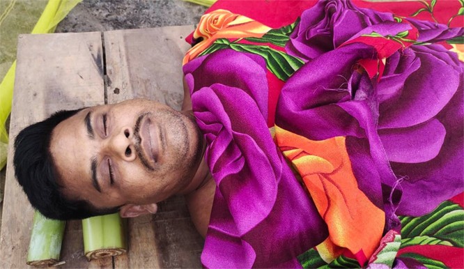 নগরকান্দায় ভিমরুলের কামড়ে একজনের মৃত্যু